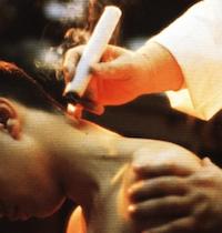 Moxibustion