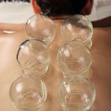 cupping therapy